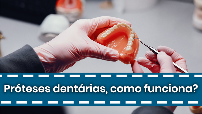 Prótese dentária, como funciona?