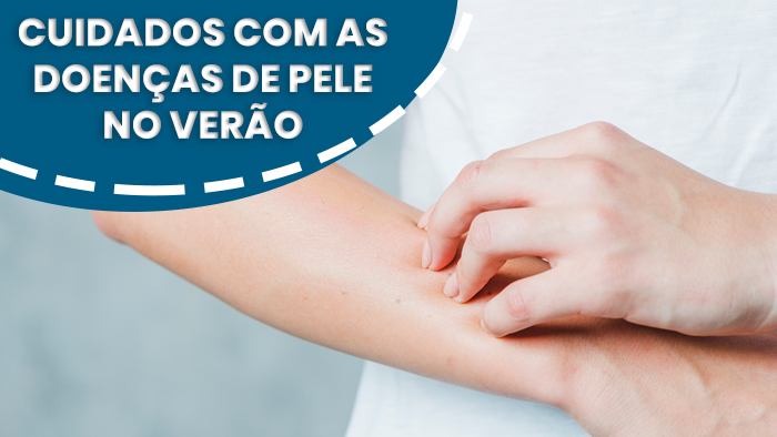 Cuidados com as doenças de pele no verão